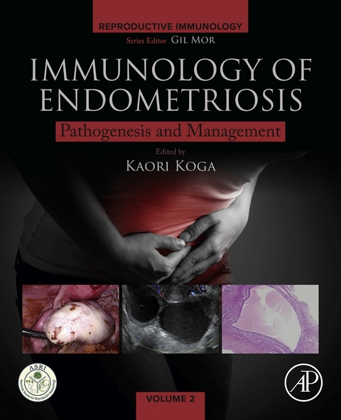 Immunology of Endometriosis - 