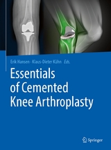 Essentials of Cemented Knee Arthroplasty - 