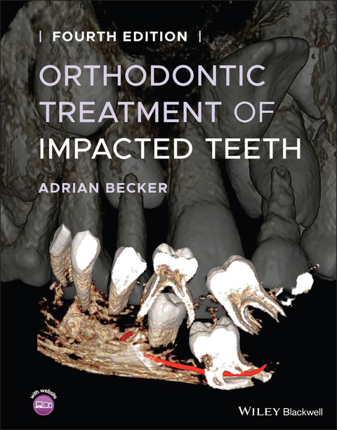 Orthodontic Treatment of Impacted Teeth -  Adrian Becker