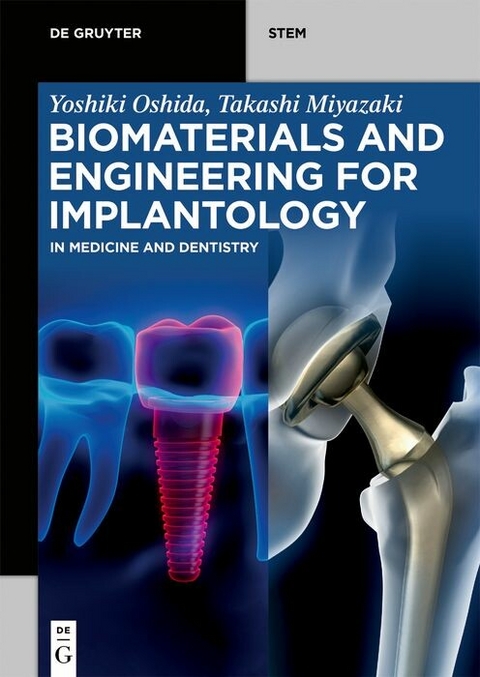 Biomaterials and Engineering for Implantology -  Yoshiki Oshida,  Takashi Miyazaki