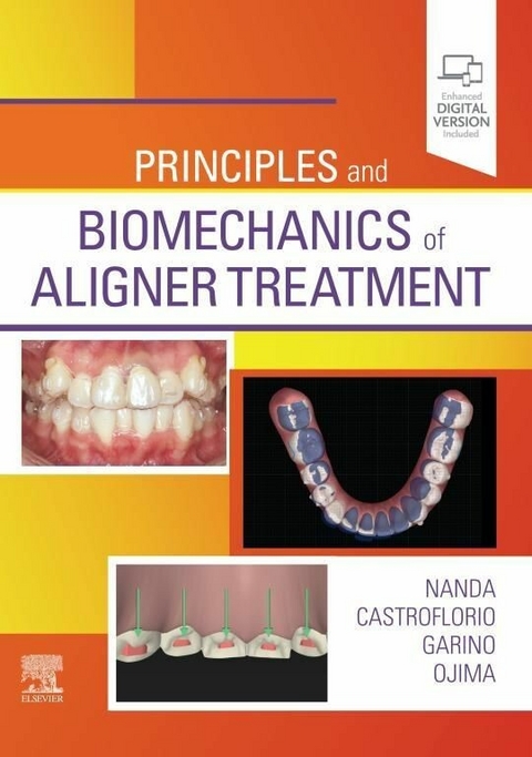 Principles and Biomechanics of Aligner Treatment - 