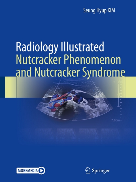 Radiology Illustrated: Nutcracker Phenomenon and Nutcracker Syndrome -  Seung Hyup Kim