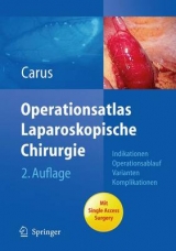 Operationsatlas Laparoskopische Chirurgie - Thomas Carus