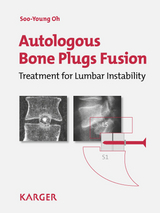 Autologous Bone Plugs Fusion - S.-Y. Oh