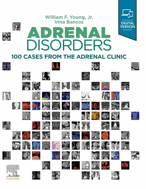 Adrenal Disorders -  Irina Bancos,  William F. Young