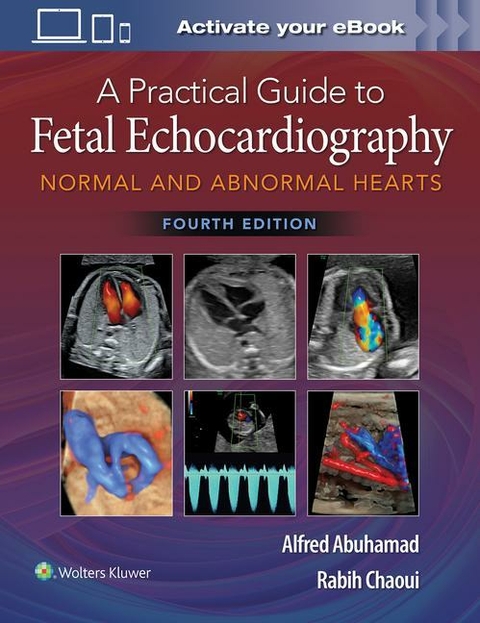 Practical Guide to Fetal Echocardiography -  Alfred Abuhamad,  Rabih Chaoui