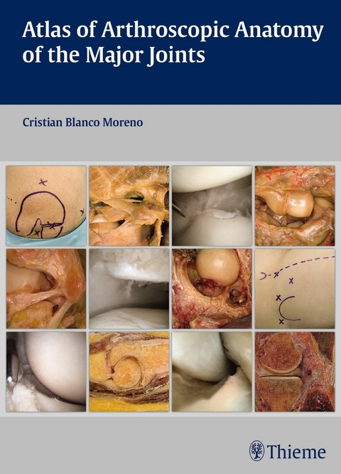 Atlas of Arthroscopic Anatomy of the Major Joints -  Cristian Blanco Moreno