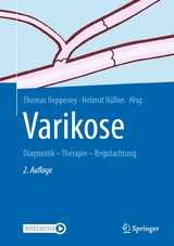 Varikose - 