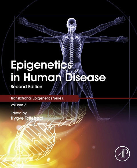 Epigenetics in Human Disease - 