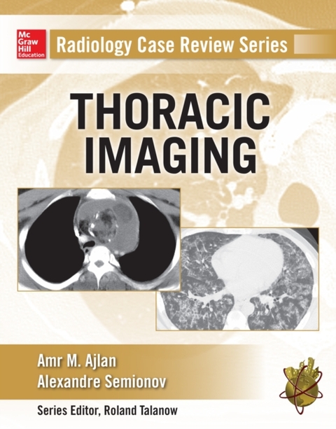 Radiology Case Review Series: Thoracic Imaging -  Amr M. Ajlan,  Alexander Semionov