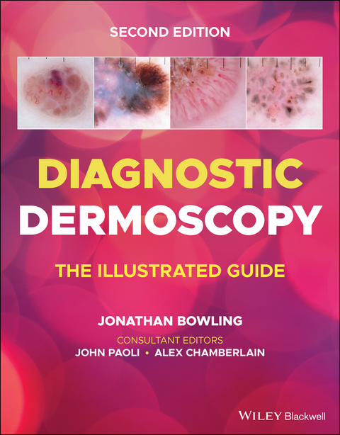 Diagnostic Dermoscopy - 