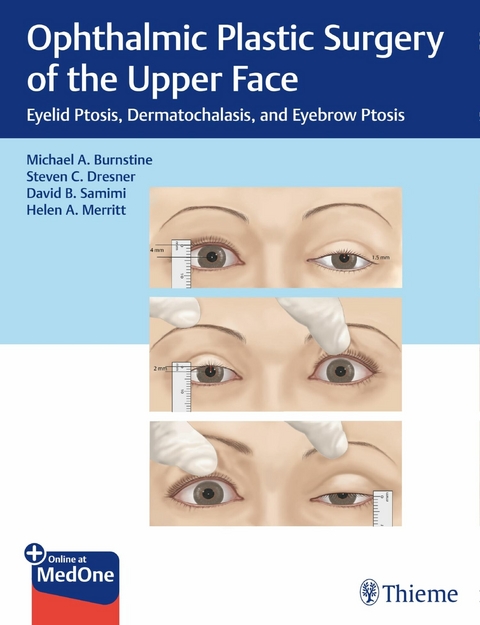 Ophthalmic Plastic Surgery of the Upper Face -  Michael A. Burnstine,  Steven C. Dresner,  David B. Samimi,  Helen A. Merritt