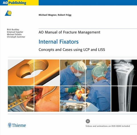 AO Manual of Fracture Management: Internal Fixators -  Michael Wagner,  Robert Frigg