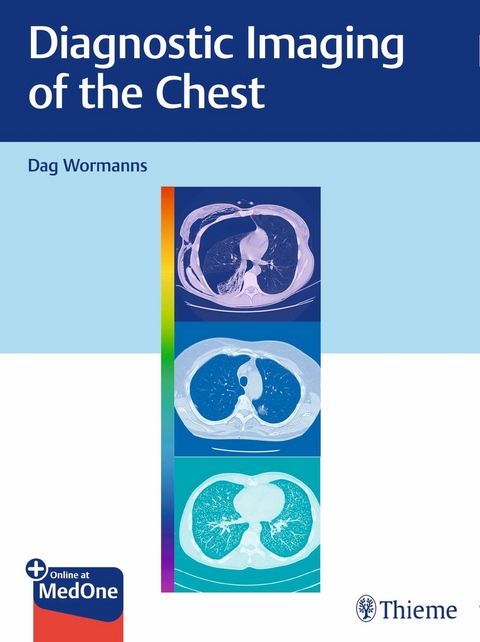 Diagnostic Imaging of the Chest - 