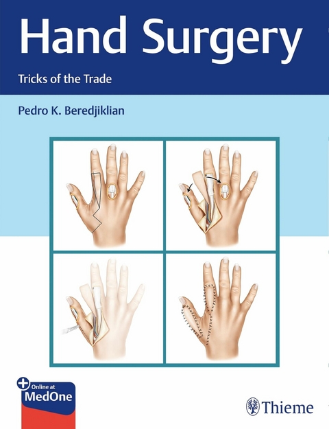 Hand Surgery - Pedro Beredjiklian
