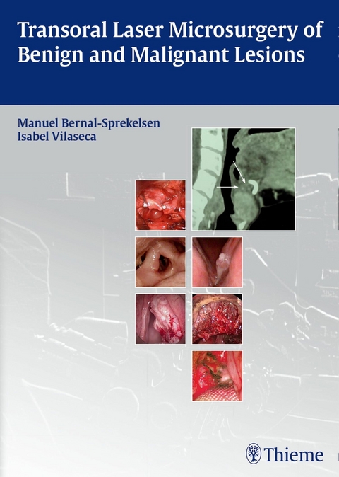 Transoral Laser Microsurgery of Benign and Malignant Lesions - 