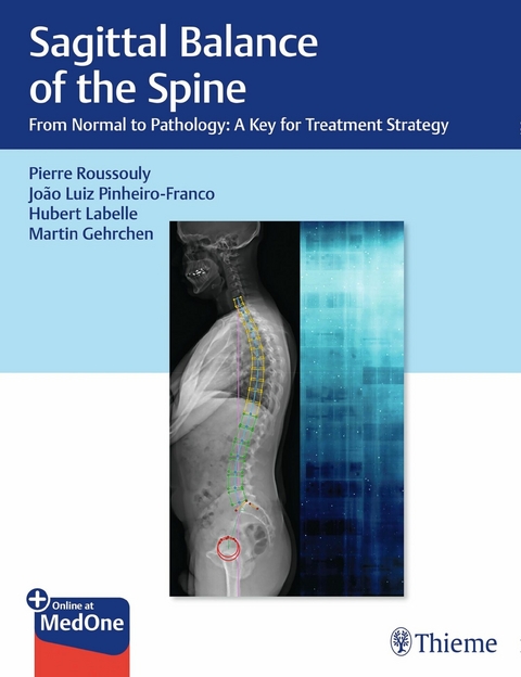 Sagittal Balance of the Spine - 