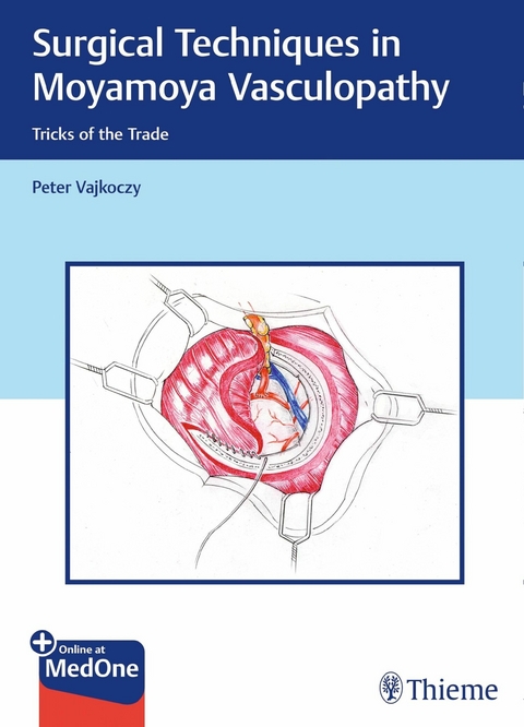 Surgical Techniques in Moyamoya Vasculopathy -  Peter Vajkoczy