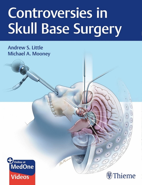 Controversies in Skull Base Surgery - Andrew S. Little, Michael A. Mooney