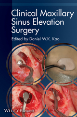 Clinical Maxillary Sinus Elevation Surgery - 