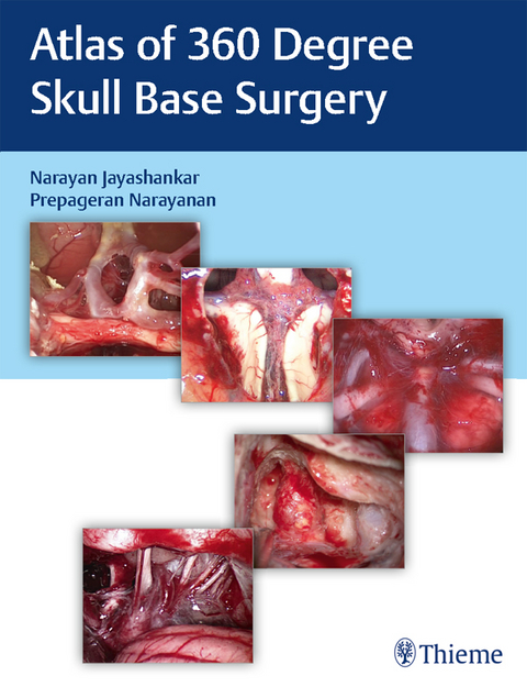 Atlas of 360 Degree Skull Base Surgery - 