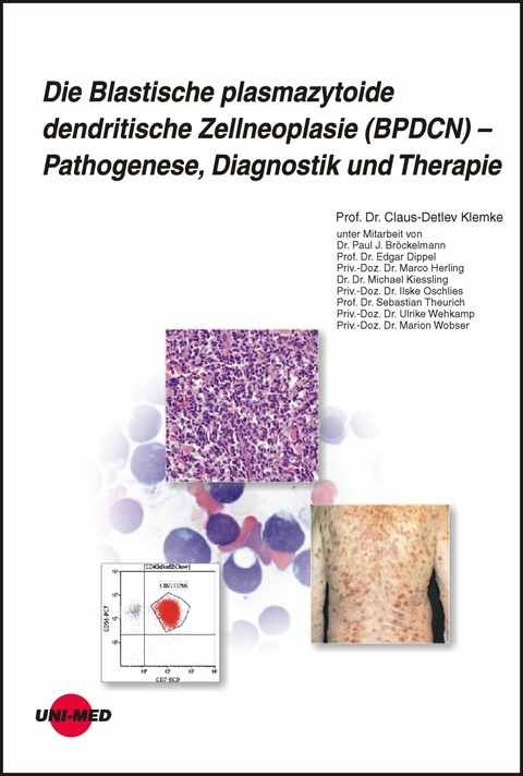 Die Blastische plasmazytoide dendritische Zellneoplasie (BPDCN) – Pathogenese, Diagnostik und Therapie - Claus-Detlev Klemke