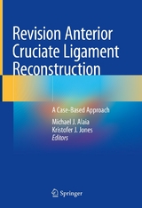 Revision Anterior Cruciate Ligament Reconstruction - 