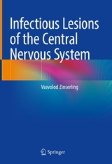 Infectious Lesions of the Central Nervous System - Vsevolod Zinserling