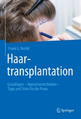 Haartransplantation -  Frank G. Neidel