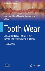 Tooth Wear - 