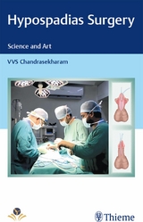 Hypospadias Surgery - VVS Chandrasekharam
