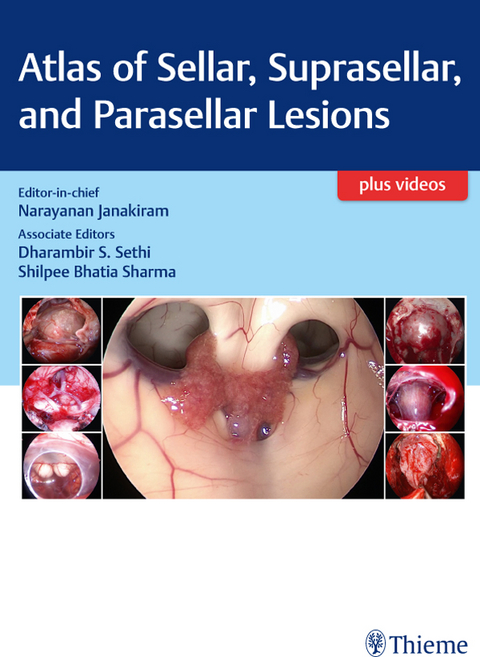 Atlas of Sellar, Suprasellar, and Parasellar Lesions - 