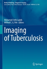 Imaging of Tuberculosis - 