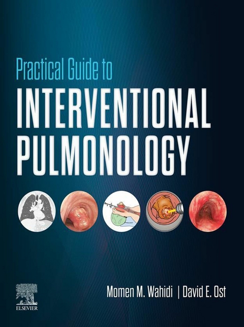 Practical Guide to Interventional Pulmonology - 