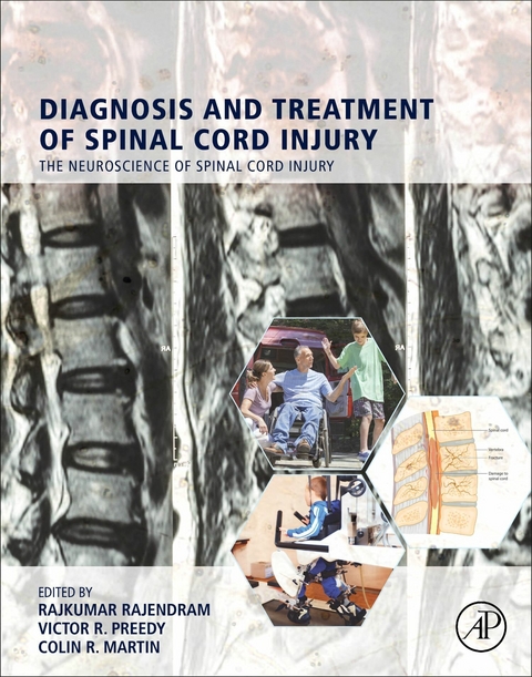 Diagnosis and Treatment of Spinal Cord Injury - 