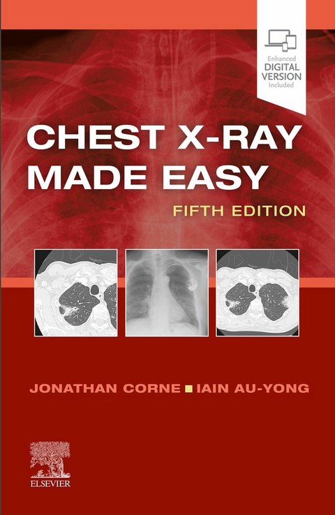 Chest X-Ray Made Easy E-Book -  Jonathan Corne,  Iain Au-Yong