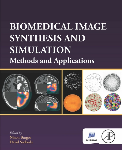 Biomedical Image Synthesis and Simulation - 