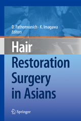 Hair Restoration Surgery in Asians - 