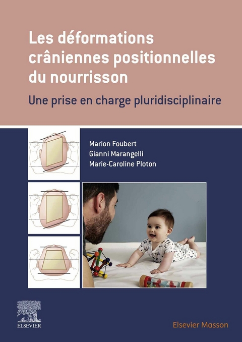 Les déformations crâniennes positionnelles du nourrisson -  Marion Foubert,  Gianni Marangelli,  Marie-Caroline Ploton