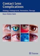 Contact Lens Complications - Hans-Walter Roth