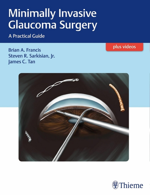 Minimally Invasive Glaucoma Surgery - Brian Francis, Steven Sarkisian, James C. Tan
