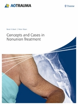 Concepts and Cases in Nonunion Treatment -  Peter Kloen,  René K. Marti