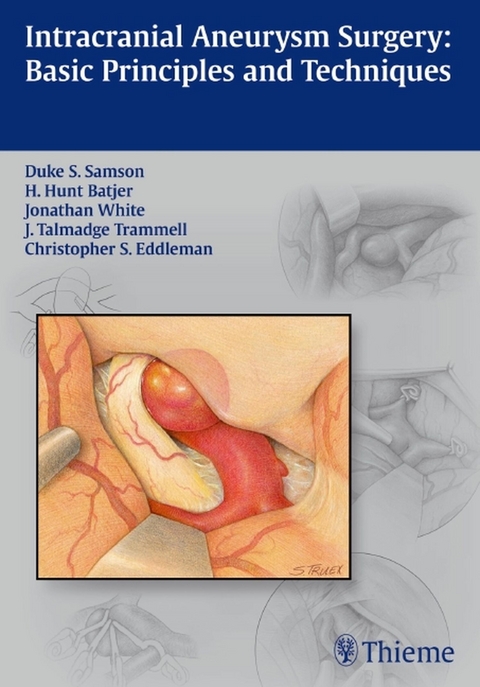 Intracranial Aneurysm Surgery - 