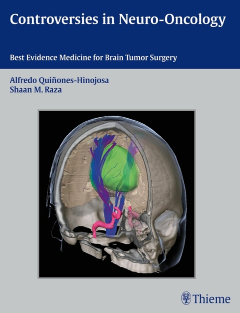 Controversies in Neuro-Oncology - 