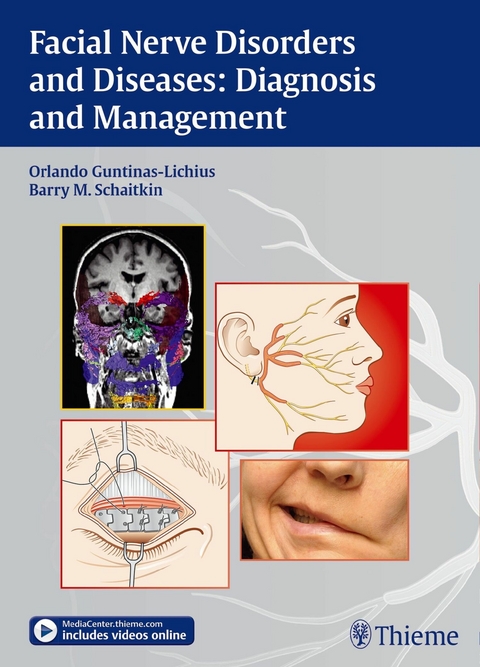 Facial Nerve Disorders and Diseases: Diagnosis and Management -  Orlando Guntinas-Lichius,  Barry Schaitkin