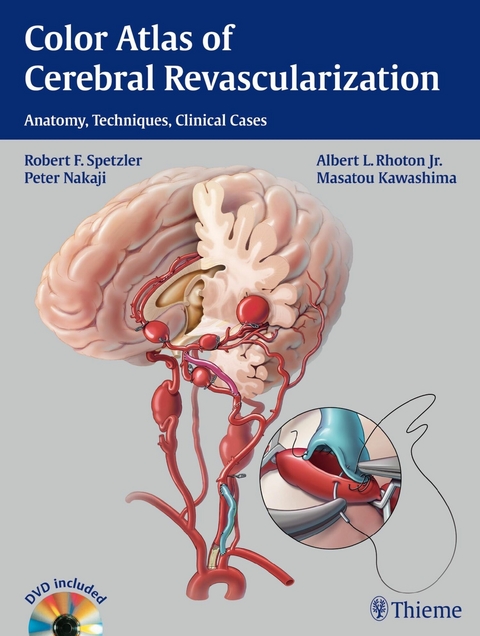 Color Atlas of Cerebral Revascularization - Robert F. Spetzler, Albert L. Rhoton, Peter Nakaji, Masatou Kawashima