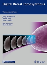 Digital Breast Tomosynthesis -  Joerg Barkhausen,  Achim Rody,  Fritz K.W. Schäfer