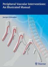 Peripheral Vascular Interventions: An Illustrated Manual -  Jürgen Schröder