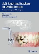 Self-Ligating Brackets in Orthodontics -  Dirk Bister,  Sebastian Baumgaertel,  Björn Ludwig