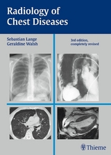 Radiology of Chest Diseases -  Sebastian Lange,  Geraldine Walsh